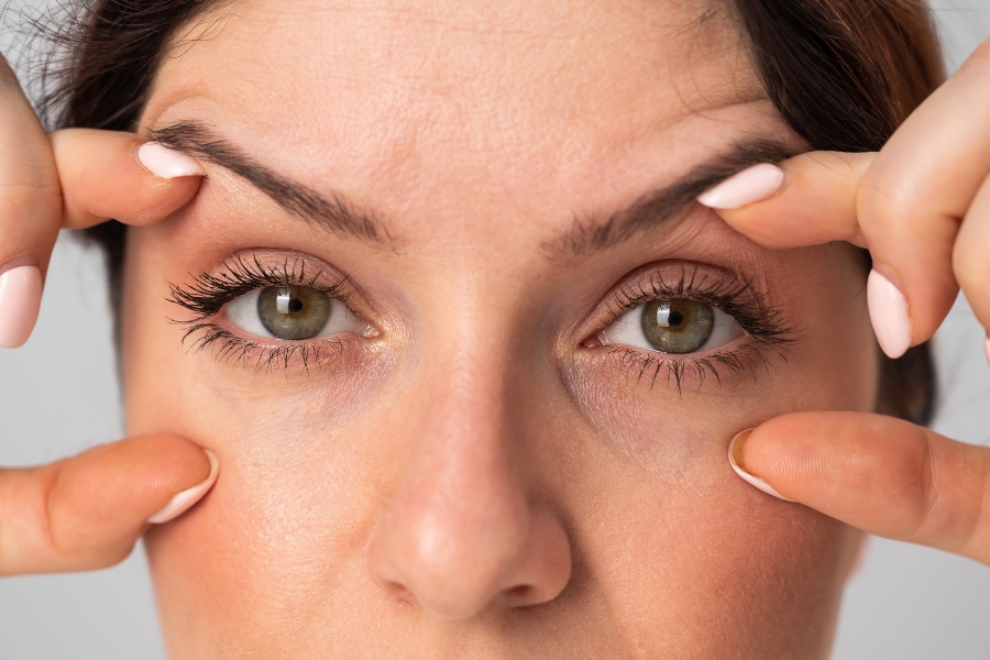 Blefaroplastyka — Zabieg na opadającą powiekę w Gdańsku